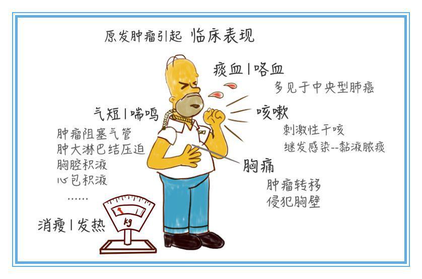 癌症患者睡觉时癌细胞会转移吗,癌症病灶反复发热