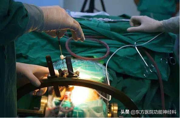 精神病药物过量危害,精神病药过量食用导致精神分裂