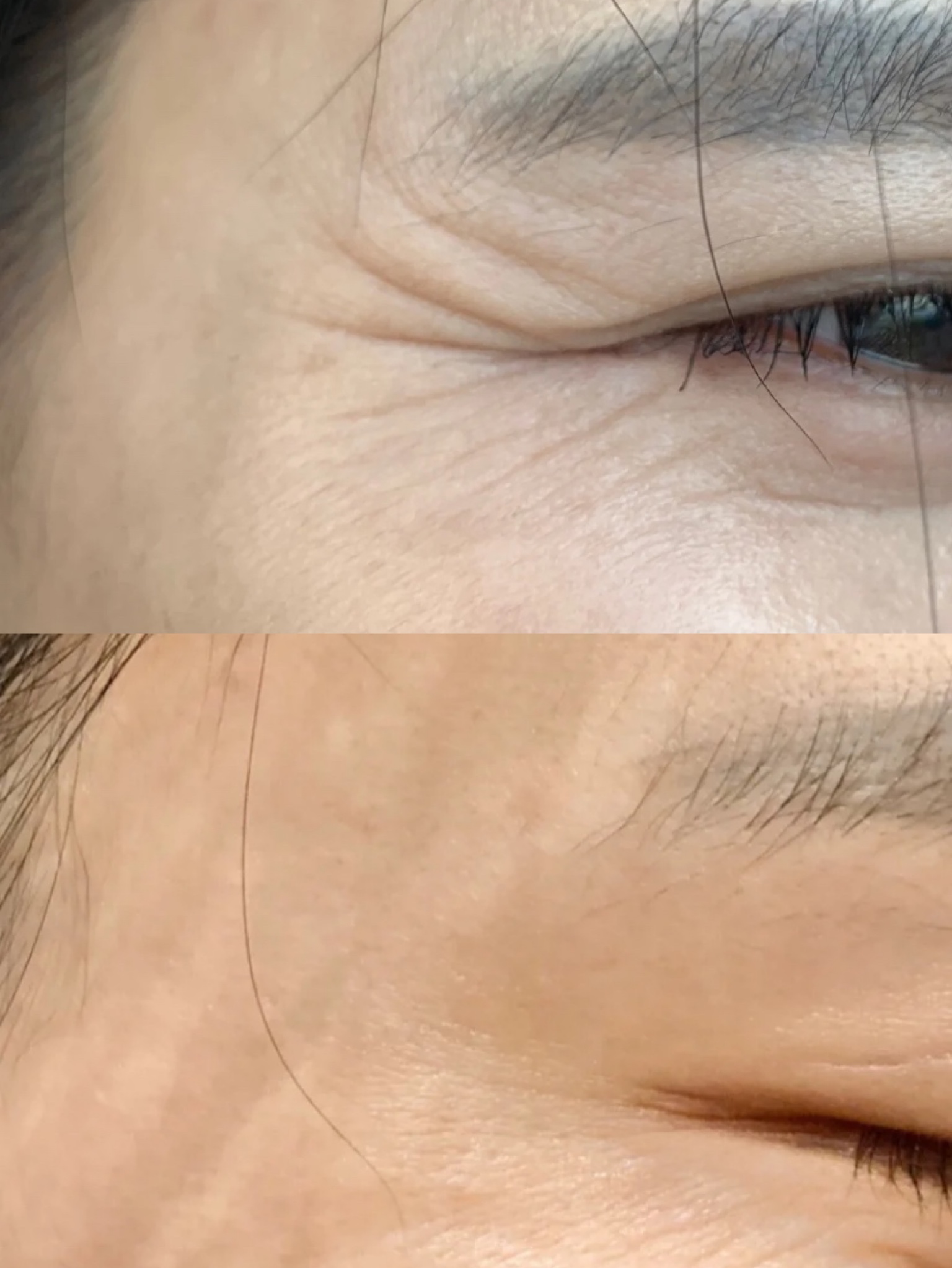 药店卖的眼霜推荐哪个牌子,无意中发现药店有一款医用眼霜