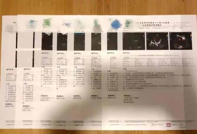 孩子感冒输液两天还是高烧不退,孩子病毒感冒高烧不退要输液吗