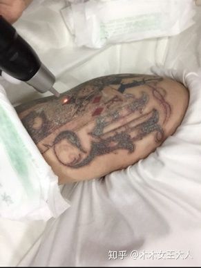 洗纹身一般要多久才能洗干净,洗纹身可以一次洗干净吗