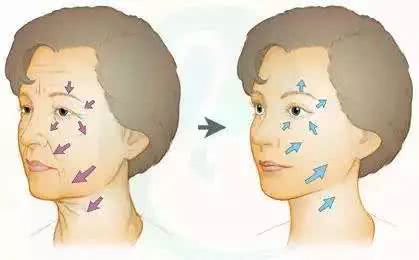 号称“1小时逆龄10年”的微整？我亲身体验了