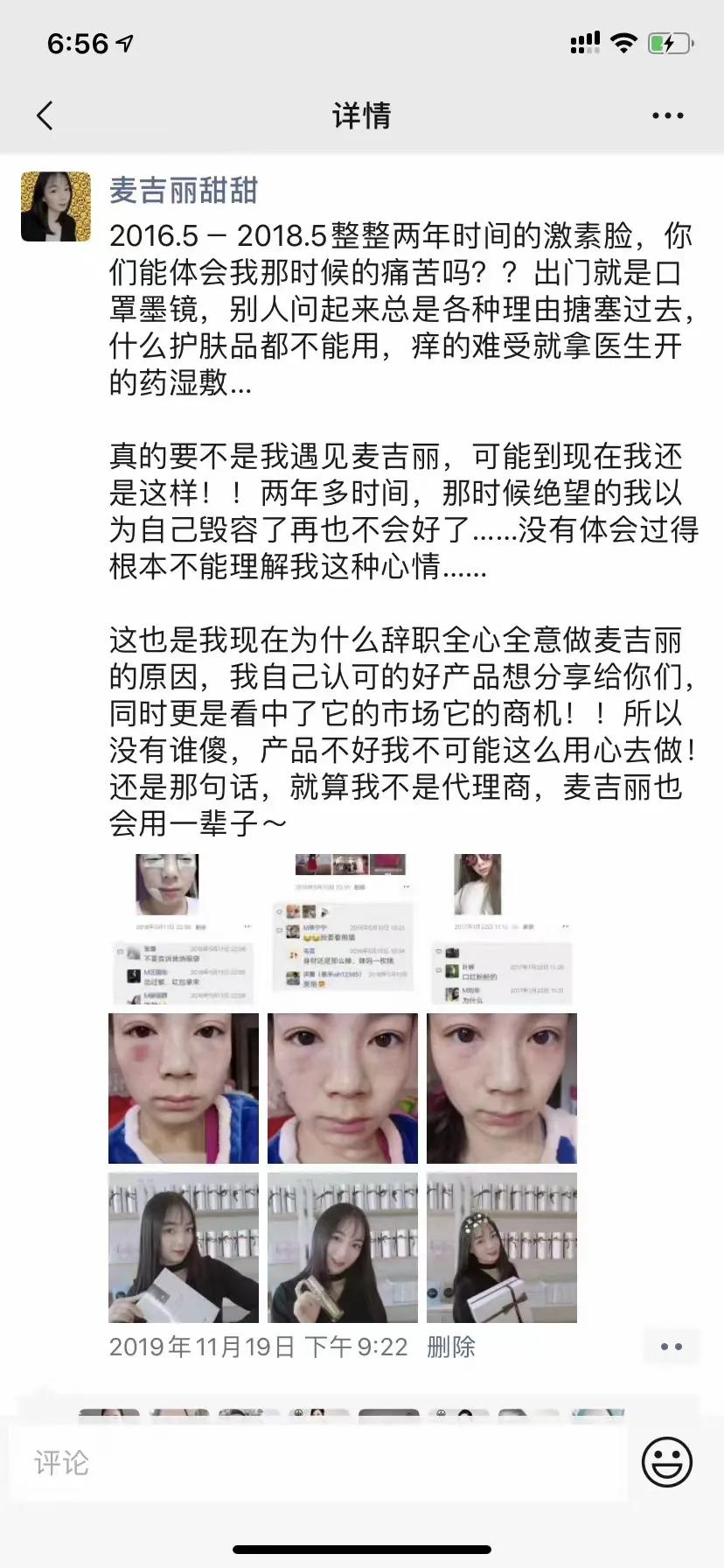 甜甜专业祛斑祛痘,甜甜祛斑直播间