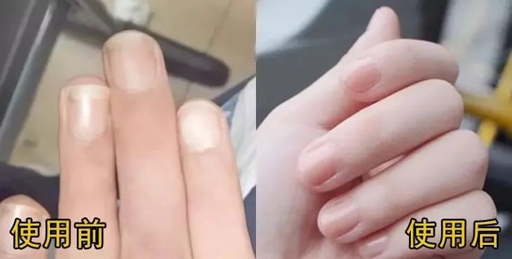 指甲刀中的劳斯莱斯,德国高端指甲剪指甲刀