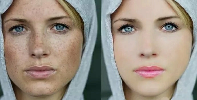 祛斑效果最好的祛斑方法,祛斑最有效的方法和技巧