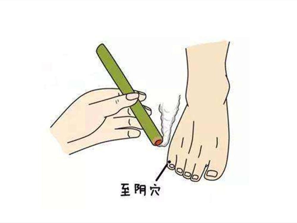 胎位不正怎么纠正最快注意事项,胎位不正怎么纠正最快海南