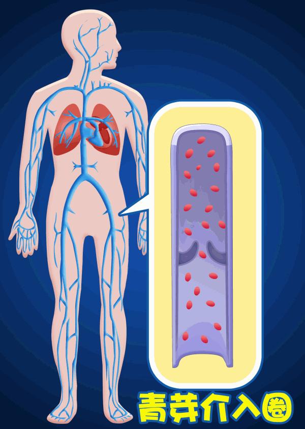 腿肿要警惕四种病,人的腿肿是什么病的前兆