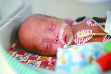 生了早产儿死了医院怎么处理,生了宝宝需要做什么修复