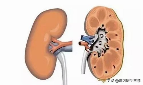 关于尿酸性肾结石的发生与预防,你了解多少?