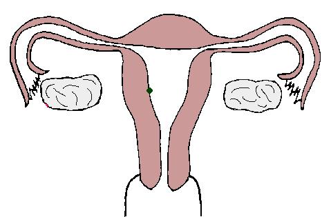 为什么不建议剖宫产,为什么有人不愿意清宫