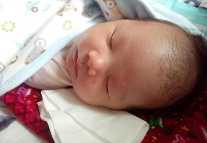 婴儿夏天脖子淹红抹什么,宝宝夏天淹脖子擦什么