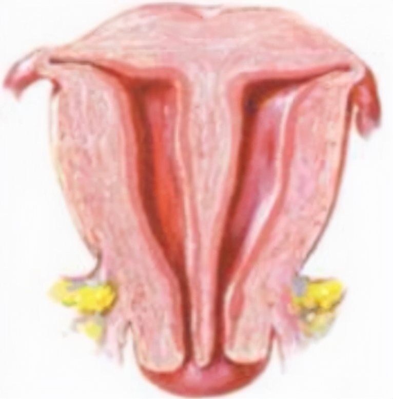 子宫畸形通过健身能改善吗,子宫畸形的最佳治疗方法