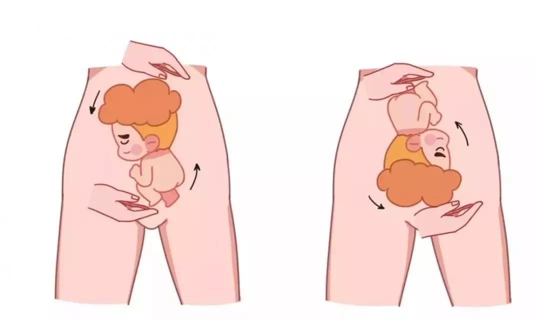 胎位中最常见的异常胎位,胎位朝上如何纠正胎位