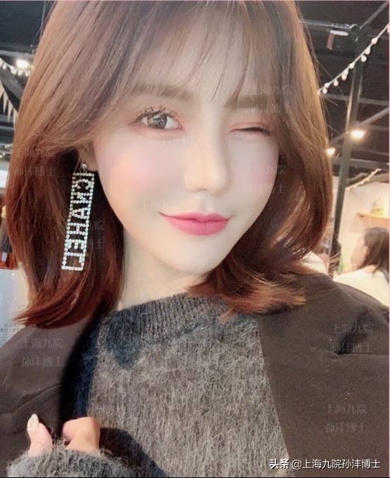 上海九院孙沣博士眼角修复,孙沣修复外眼角