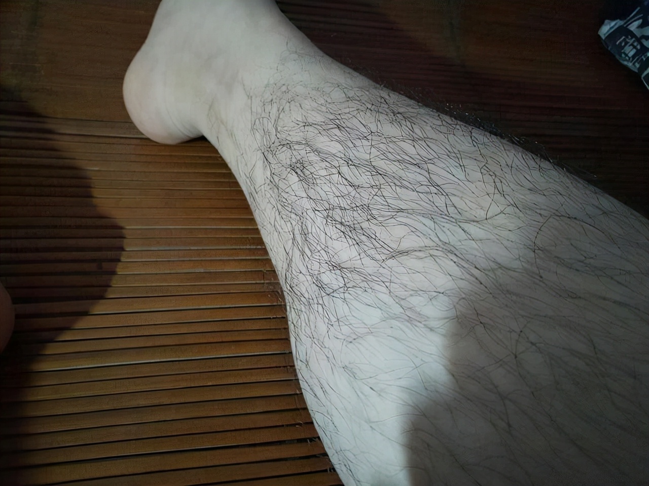 男性腿毛稀少是肾不好吗,男性腿毛少代表什么