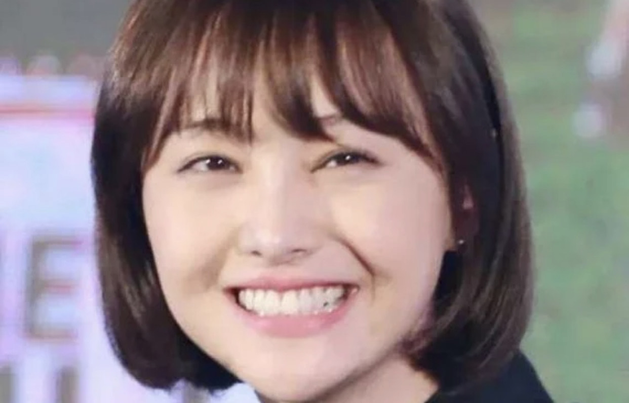 笑起来虽然有点皱纹但更喜欢大笑,一笑脸颊的皱纹很明显怎么办