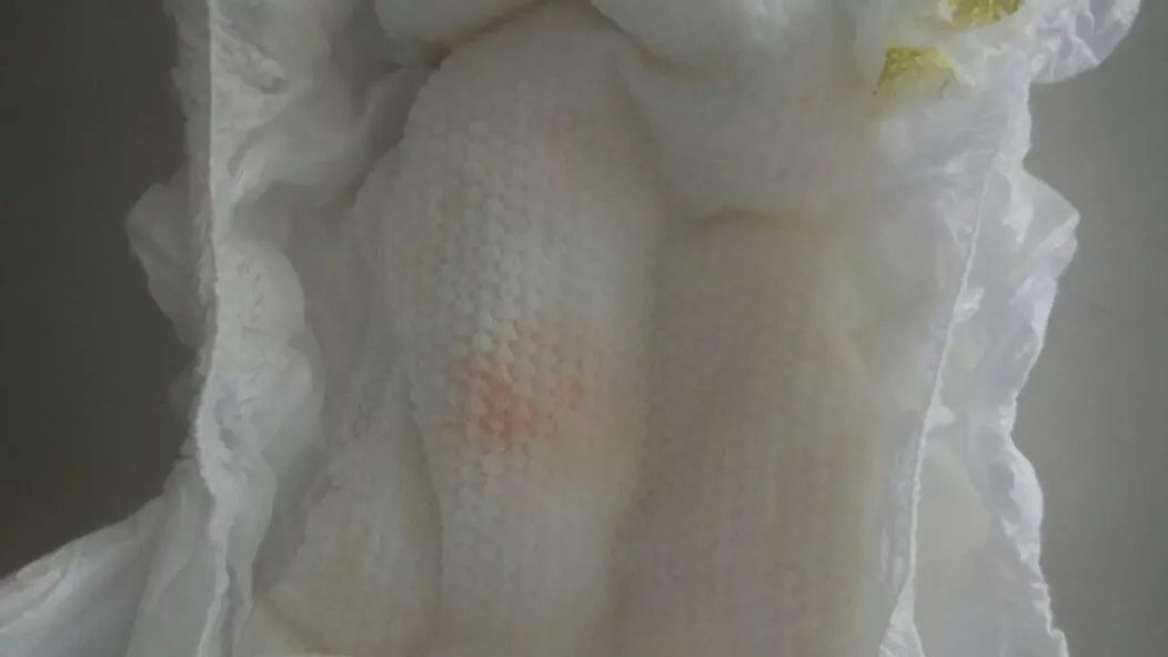 体重下降、发抖、尿红血，新生儿的“非常”现象你知道吗？转载