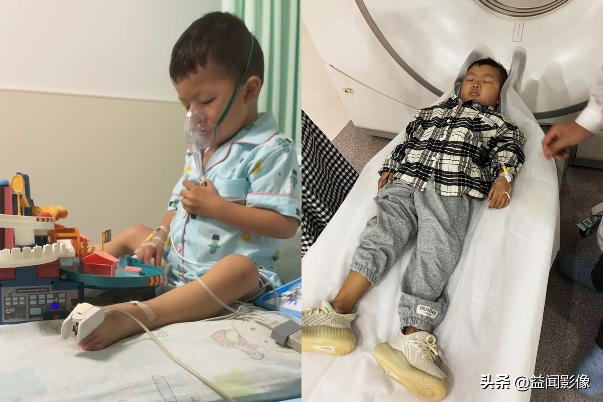 四周岁男孩腹胀,6岁男童肚痛呕吐消化不良