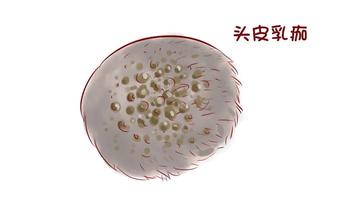 婴儿头上的污垢可以用香油吗,为什么婴儿头上长污垢