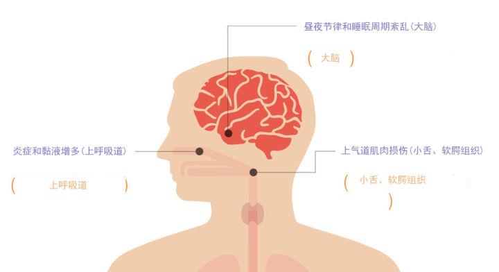 科普｜吸烟如何影响打鼾？