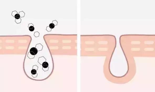 吸黑头神器去粉刺角质收缩毛孔,皮肤清洁收缩毛孔黑头角质