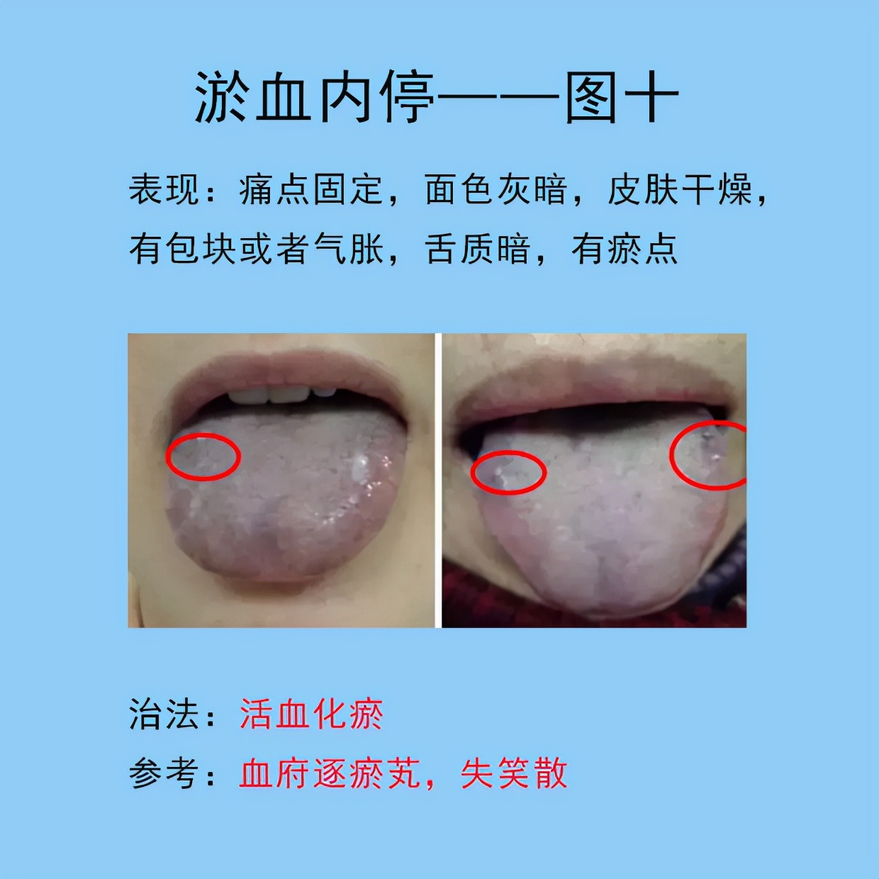 根据舌象判断用哪种调理脾胃的药,脾胃常见的症状
