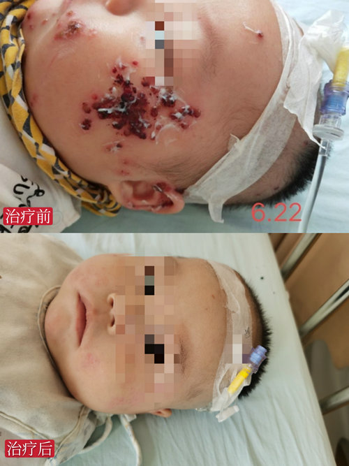 梅雨天宝宝怎么护理,梅雨季节如何护理宝宝