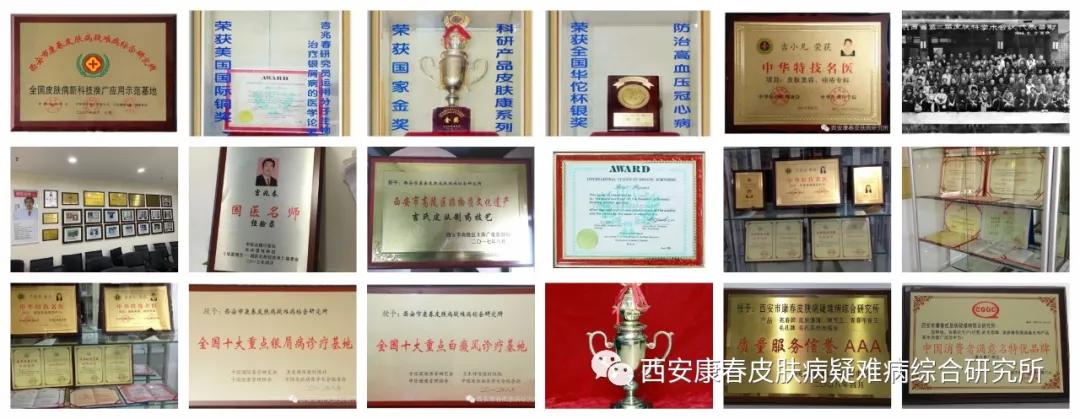 西安康春皮肤病研究所产品,西安康春皮肤病研究所官网