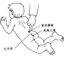 宝宝感冒了吃药见效快好吗,小儿感冒一推就好了