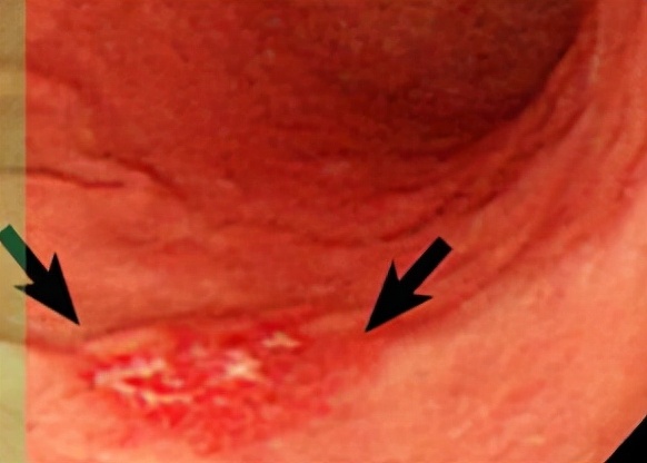 我不是药神,我不是财迷!若患胃癌,这些靶向药你有能力负担吗?