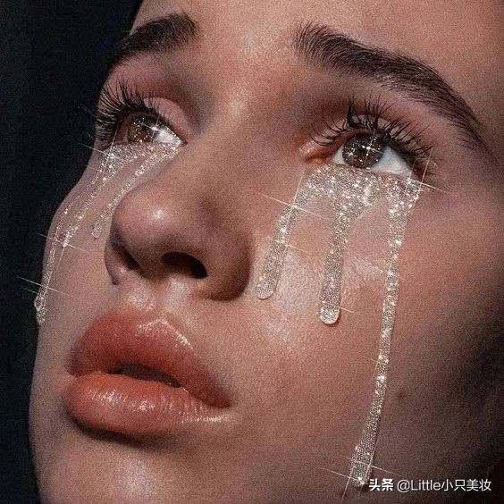 去眼纹打肉毒素吗,去眼纹打多少肉毒素合适