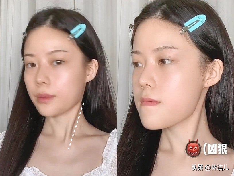 短方脸怎么修饰脸型,方脸瘦下去脸颊凹陷怎么办