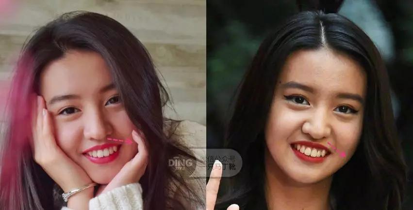 凸嘴微笑练习方法表情管理,前凸嘴怎么做表情管理