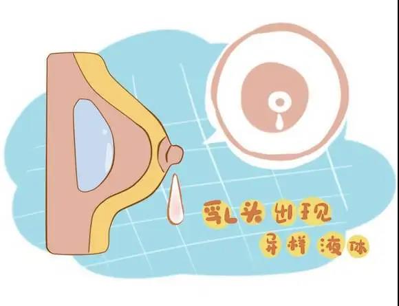 健康学堂|“流泪”的乳头，你关注了吗？