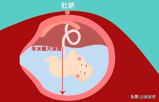 羊水过多的原因分析,羊水浑浊的原因和解决方法