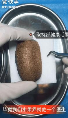 香蕉割包皮,洋葱剖腹产?这是我见过最秀的医生