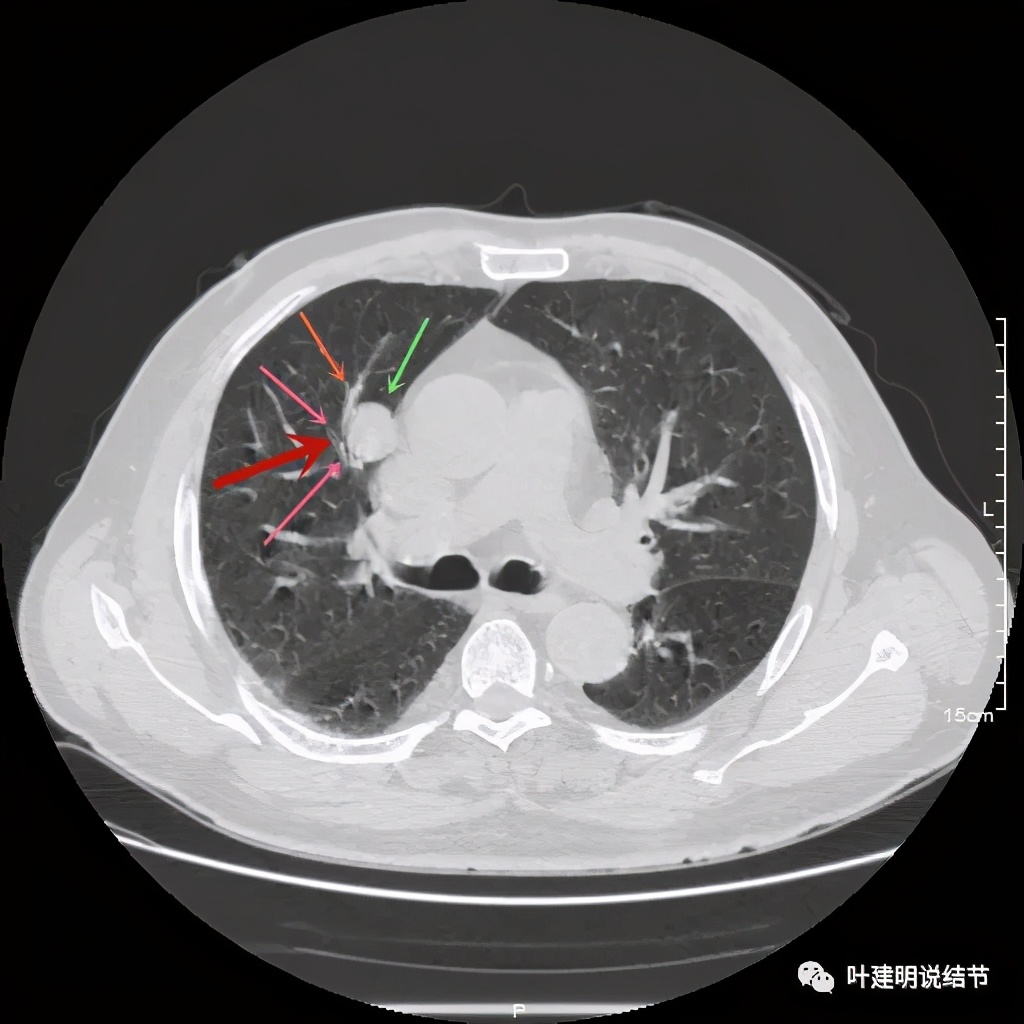 误诊报告图片,误诊案例及案例分析