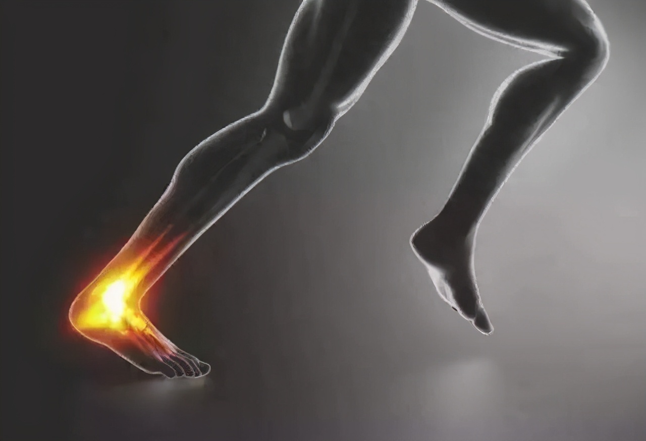 跟腱阿喀琉斯,跟腱撕裂的阿喀琉斯