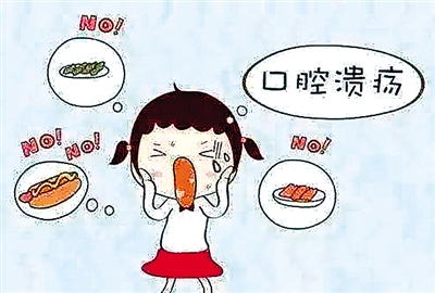 口腔溃疡预防与治疗用什么方法,关于口腔溃疡的日常用药