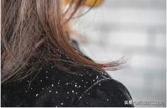 皮屑头屑,干皮冬季头屑多怎么办