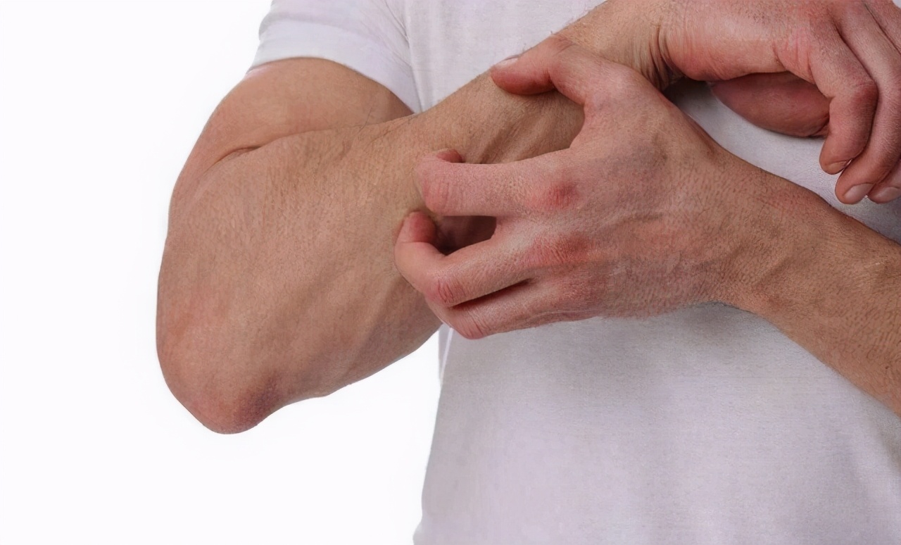 皮肤瘙痒症分型与用药大全,大面积皮肤瘙痒警惕9种疾病