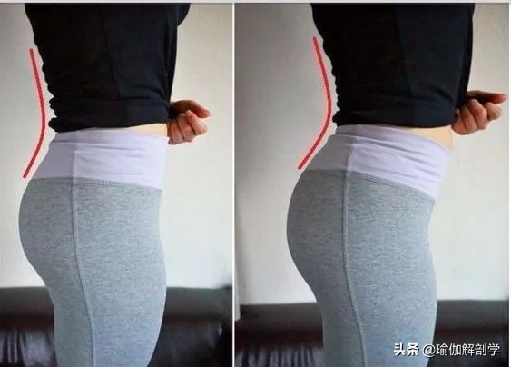 练瑜伽纠正骨盆前倾后腰椎受伤,练瑜伽前屈老是弓背怎么办