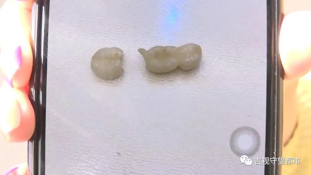 长春市超龙牙博士口腔,牙博士口腔烤瓷牙多少钱