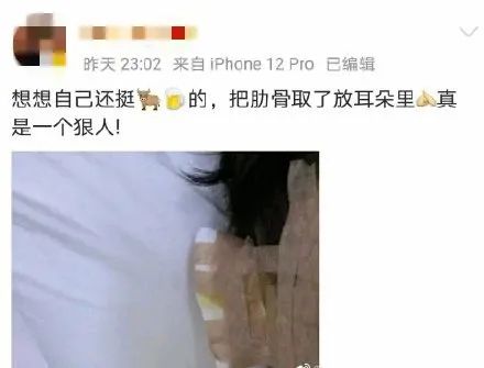 私密整容紧缩手术在中国合法吗,整容医院做私密收紧术要住院吗