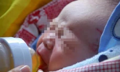 花椒面止血正确吗,花椒面止血吗