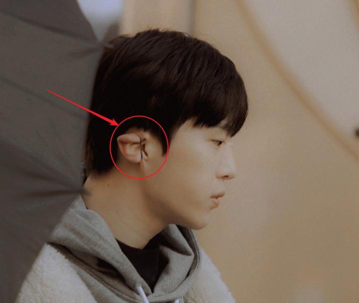 水肿张艺兴,张艺兴起床水肿