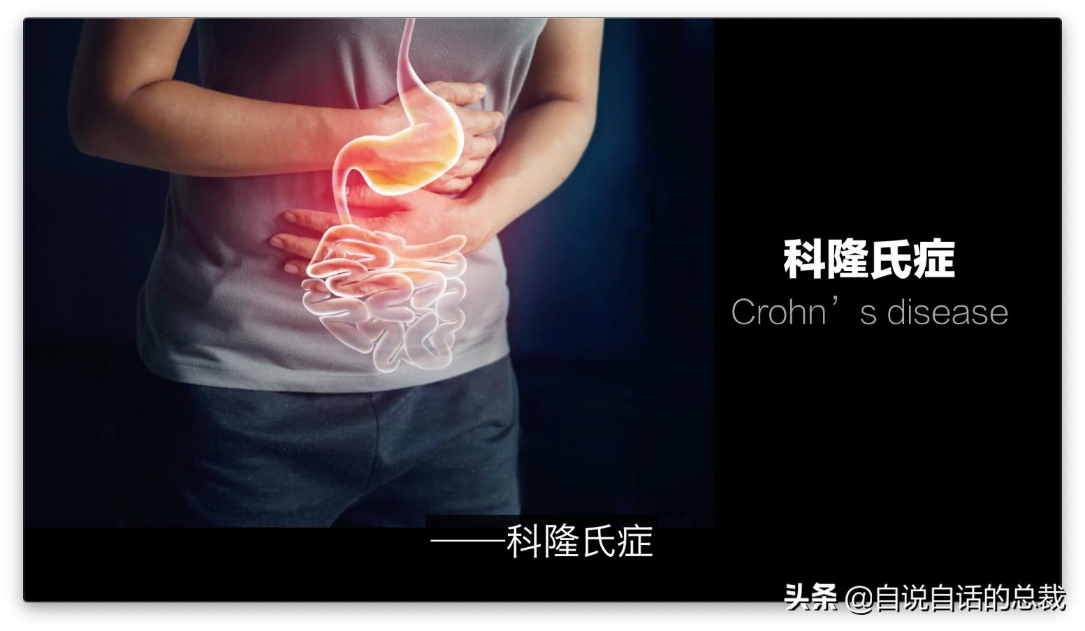 吃翔救命，最奇葩的药，人体“第二大脑”的五个惊奇