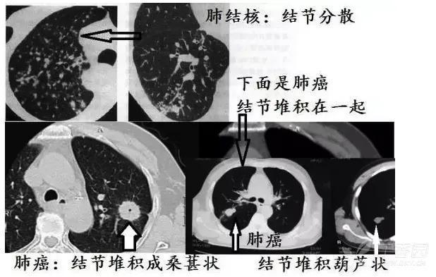 混世魔王重出江湖,混世魔王再次重生