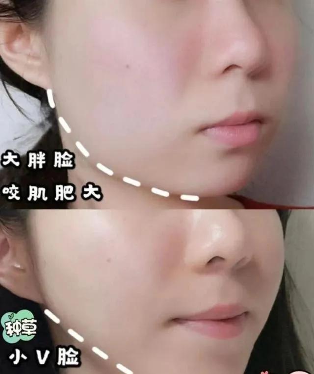 韩国瘦脸面膜真的有用吗,瘦脸面膜真的是小v脸必备