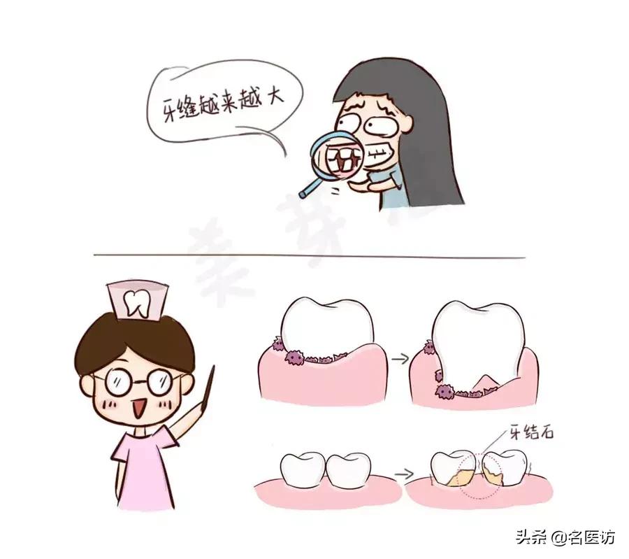 洗牙攻略,洗牙全攻略